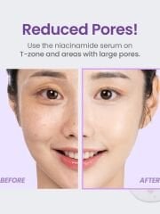 TIRTIR Niacinamide 20% Serum – Niacinamide İçeren Serum 30ml