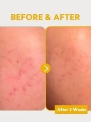 TIRTIR Pure Vitamin C24 Serum %24 Vitamin C ve Kolajen İçeren Serum 30ml